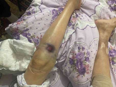Ankara'da bakc deheti: 91 yandaki yal kadn hastanede ölüm kalm sava v